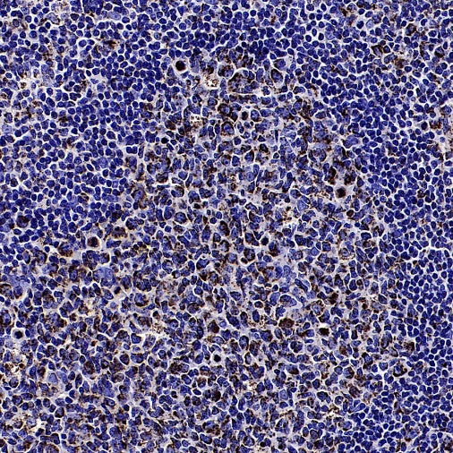 Cleaved Caspase-3 (Asp175) Recombinant Rabbit mAb (S-2817)