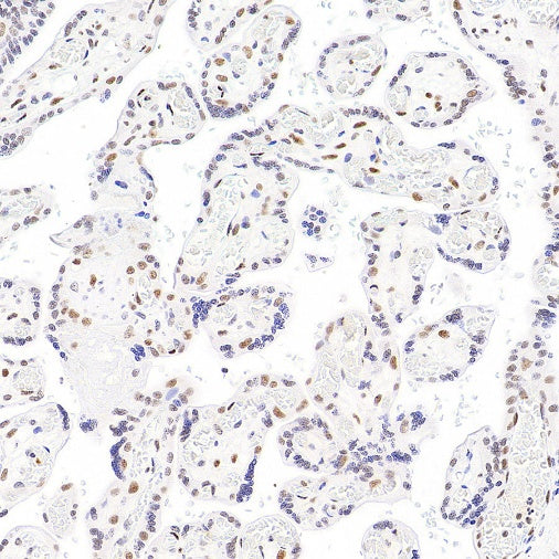 SP100 Rabbit Polyclonal Antibody