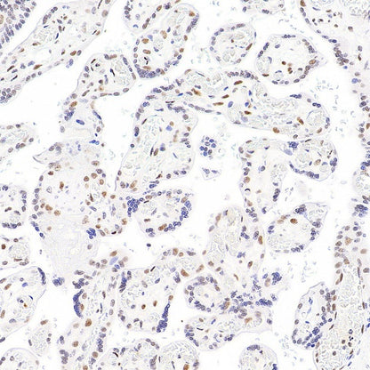 SP100 Rabbit Polyclonal Antibody