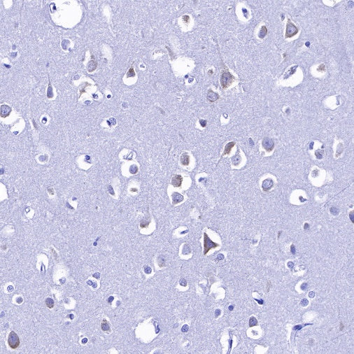 S6 Ribosomal Protein Recombinant Rabbit mAb (S-479-1)