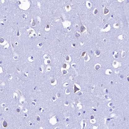 S6 Ribosomal Protein Recombinant Rabbit mAb (S-479-1)