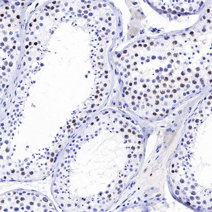 CHAF1b Recombinant Rabbit mAb (S-R316)