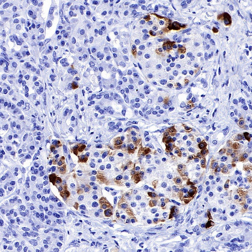 IGFBP2 Recombinant Rabbit mAb (S-808-24)