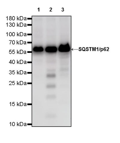 SQSTM1/p62 Recombinant Rabbit mAb (S-R346)