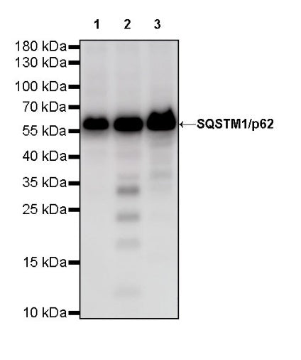SQSTM1/p62 Recombinant Rabbit mAb (S-R346)