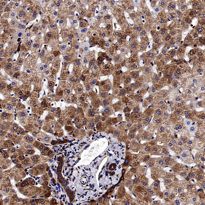 YB1 Recombinant Rabbit mAb (S-1748-144)