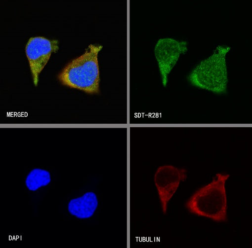 PGP9.5 Recombinant Rabbit mAb (S-R281)