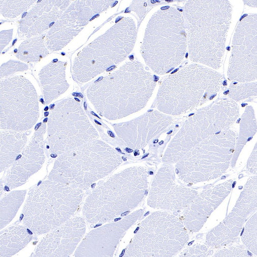 S-RMab® MUC1/EMA Recombinant Rabbit mAb (SDT-776-49)