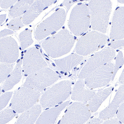 S-RMab® MUC1/EMA Recombinant Rabbit mAb (SDT-776-49)