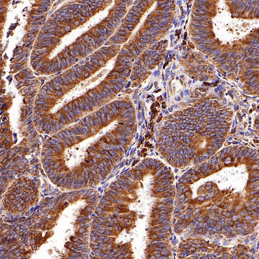 GRP94 Recombinant Rabbit mAb (S-R268)