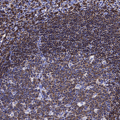 PTPN6 Rabbit Polyclonal Antibody