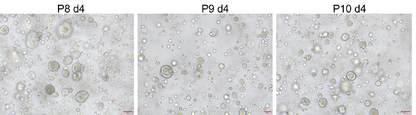 R-Spondin1/RSPO1 Protein, Human类器官培养专用