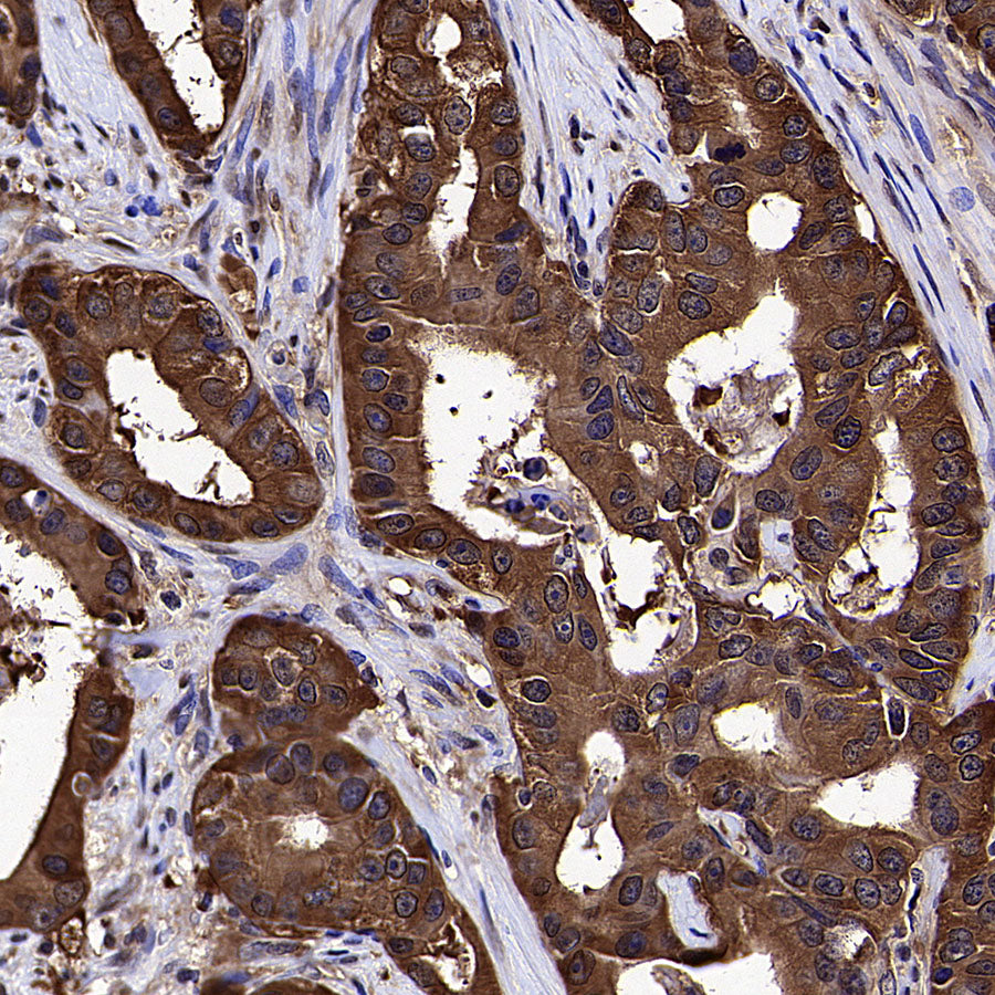 HSP90 Recombinant Rabbit mAb (S-5412)
