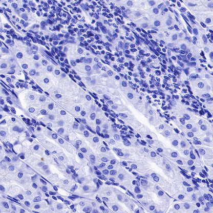 PTH Recombinant Rabbit mAb (SDT-407-4)