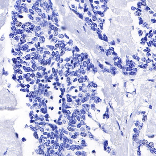 TPO Recombinant Rabbit mAb (SDT-420-57)