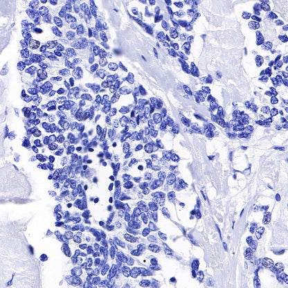 TPO Recombinant Rabbit mAb (SDT-420-57)