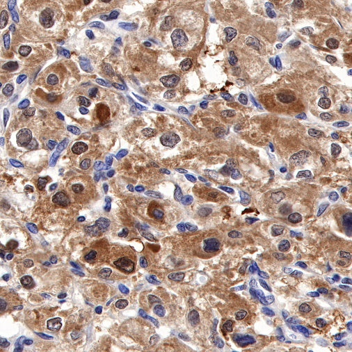 TFE3 Recombinant Rabbit mAb (SDT-760-34)