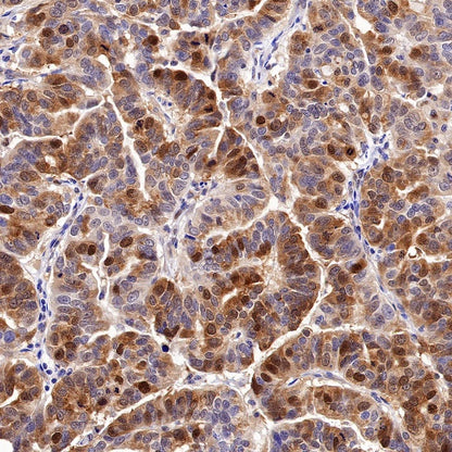 CDK2 Recombinant Rabbit mAb (S-1308-13)