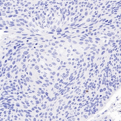 CDKN2A/p16 INK4A Recombinant Mouse mAb (SDT-4675)