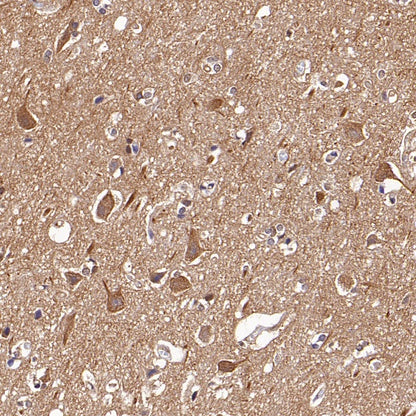DRP1 Recombinant Rabbit mAb (S-1927-27)