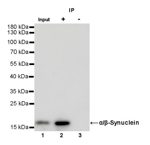 α/β-Synuclein Recombinant Rabbit mAb (S-309-72)