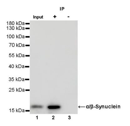 α/β-Synuclein Recombinant Rabbit mAb (S-309-72)