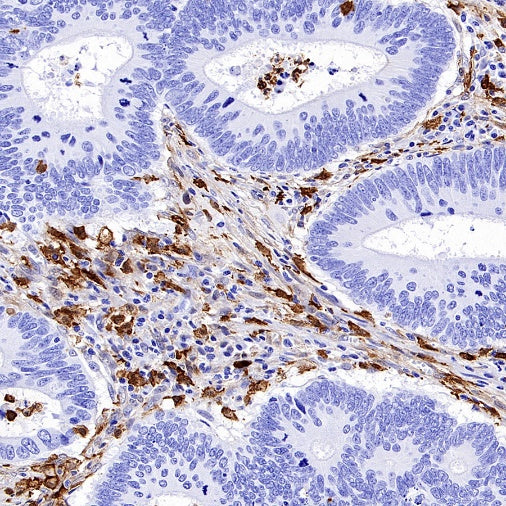 FAP Recombinant Rabbit mAb (S-3094-29)