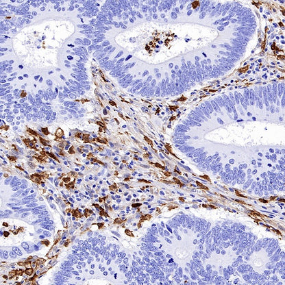 FAP Recombinant Rabbit mAb (S-3094-29)