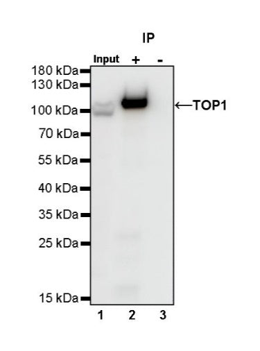 Topoisomerase I/TOP1 Recombinant Rabbit mAb (S-822-60)