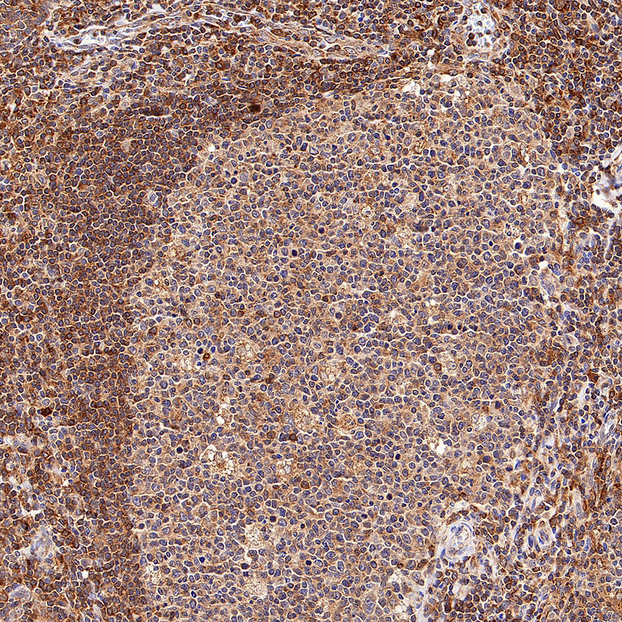 Urokinase Recombinant Rabbit mAb (S-5949)