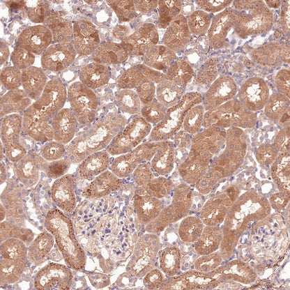 PI3 Kinase p85 Recombinant Rabbit mAb (SDT-R108)