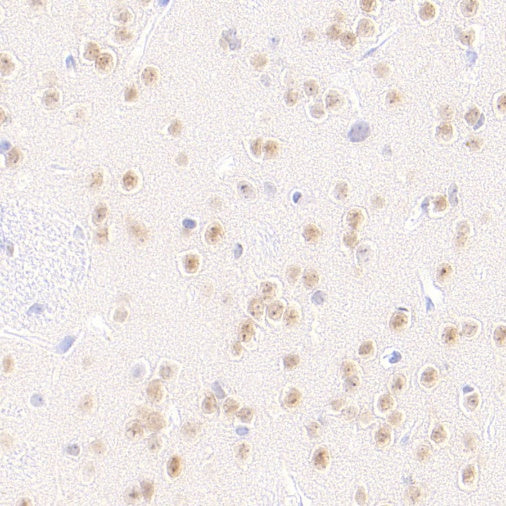 LMO4 Recombinant Rat mAb (S-5963)