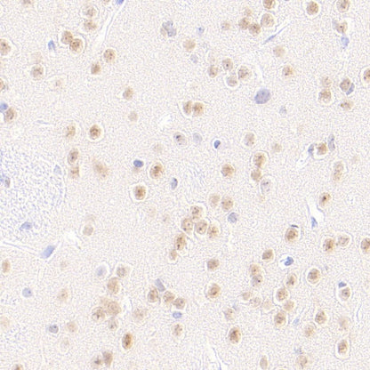 LMO4 Recombinant Rat mAb (S-5963)