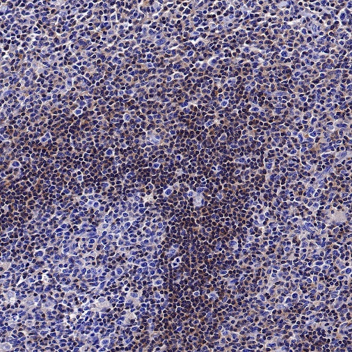 14-3-3 zeta Recombinant Rabbit mAb (S-1092-31)