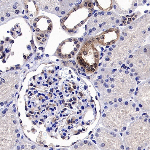 PPIA Recombinant Rabbit mAb (S-2406-28)