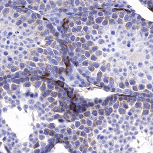 IMP-3 Recombinant Rabbit mAb (S-439-10)