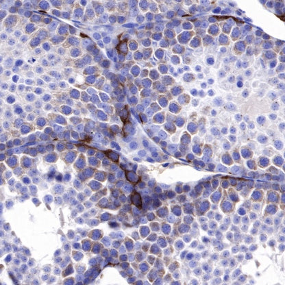 IMP-3 Recombinant Rabbit mAb (S-439-10)