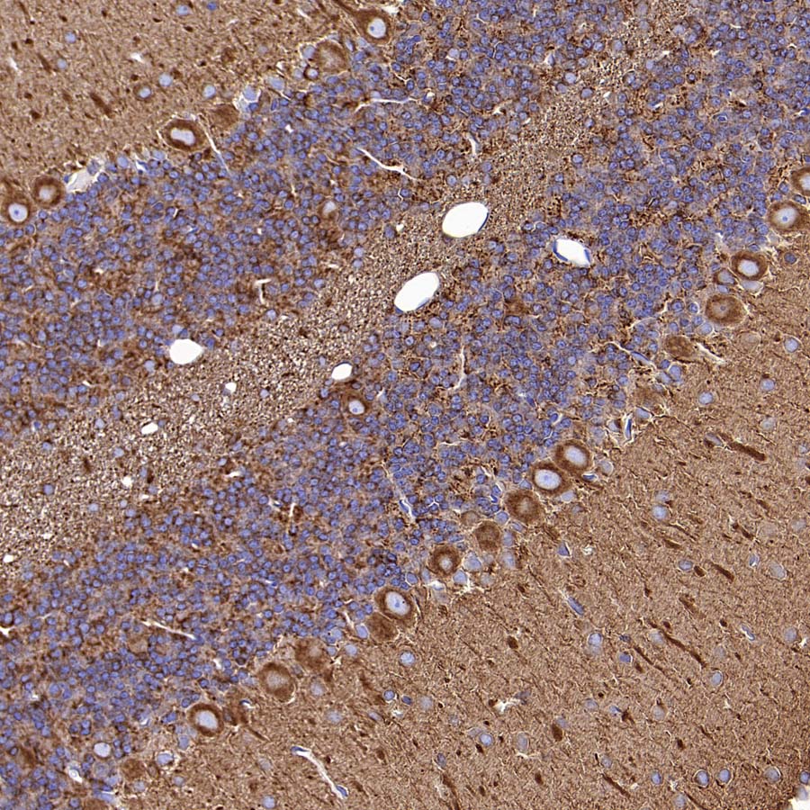 Beta III Tubulin Recombinant Rabbit mAb (S-5529)