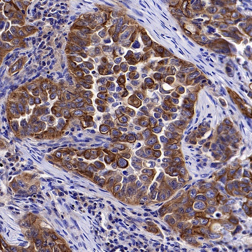 gamma Tubulin Recombinant Rabbit mAb (S-2204-13)