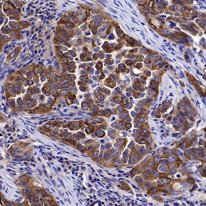 gamma Tubulin Recombinant Rabbit mAb (S-2204-13)