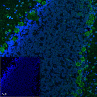 Parvalbumin Recombinant Rabbit mAb (S-1620-10)
