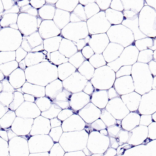 UCP1 Recombinant Rabbit mAb (SDT-2275-37)