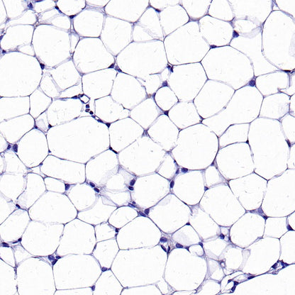 UCP1 Recombinant Rabbit mAb (SDT-2275-37)