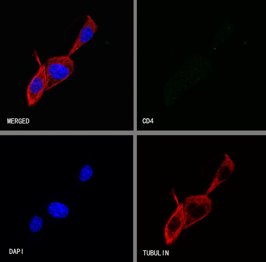 CD4 Recombinant Rabbit mAb (S-6203)