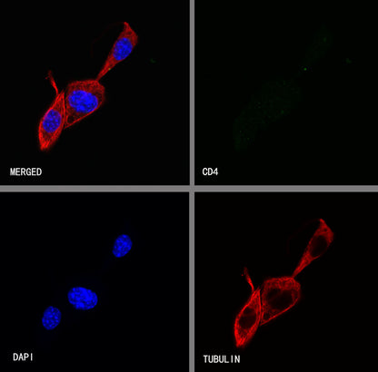 CD4 Recombinant Rabbit mAb (S-6203)