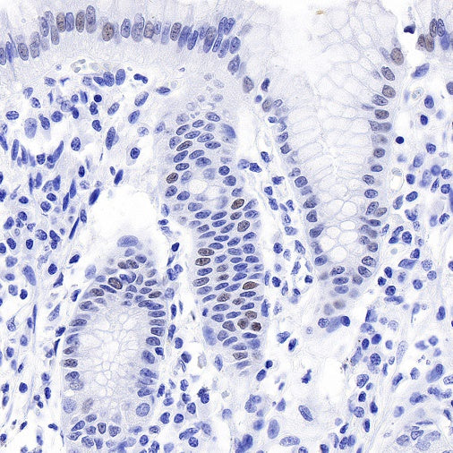 JunB Recombinant Rabbit mAb (S-670-242)