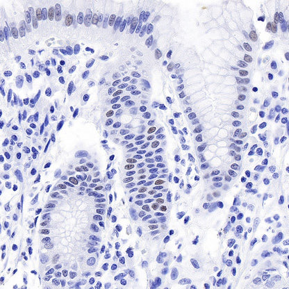 JunB Recombinant Rabbit mAb (S-670-242)