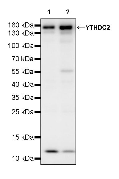 YTHDC2 Recombinant Rabbit mAb (S-3338-41)