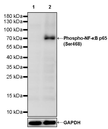 Phospho-NF-κB p65 (Ser468) Recombinant Rabbit mAb (S-1124-133)