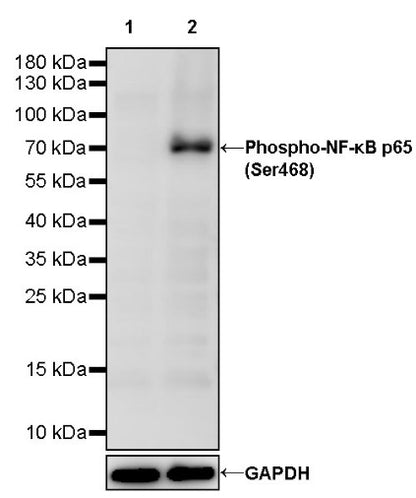 Phospho-NF-κB p65 (Ser468) Recombinant Rabbit mAb (S-1124-133)